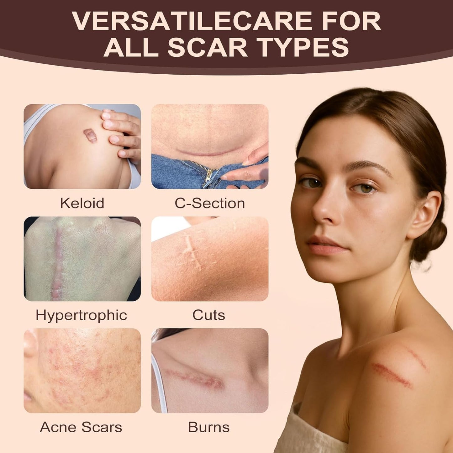 Martvera™ Silicon Scar Stick