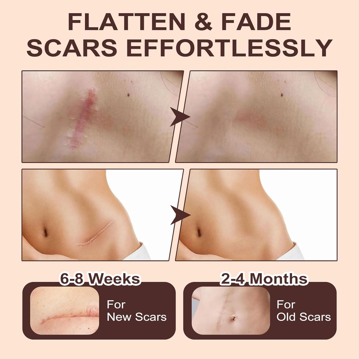 Martvera™ Silicon Scar Stick