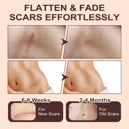 Martvera™ Silicon Scar Stick