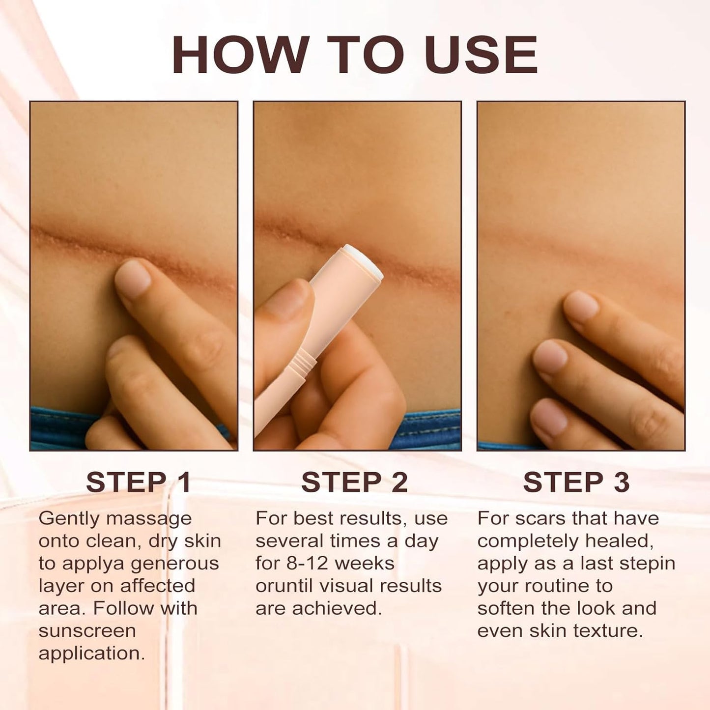 Martvera™ Silicon Scar Stick